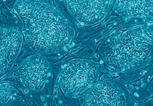 Stem Cells