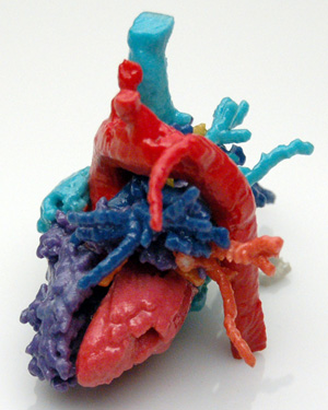 3D Printed Heart