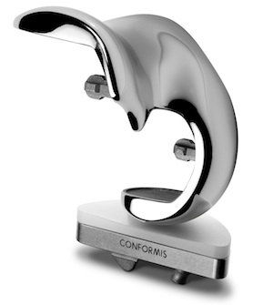 ConforMIS Implant ConforMIS implants leverage 3D printing to ensure a tailored fit. Courtesy of ConforMIS.