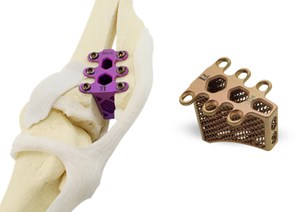 These titanium implants will have your best friend up and running again in no time. Courtesy of 3DS.