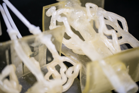 Buiilt with flexible TangoPlus, the model of the brain aneurism was able to approximate both the look and feel of the problem area. Courtesy of Stratasys.
