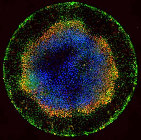 Stem cell research has the potential to cure a large number of diseases. Courtesy of NIH.