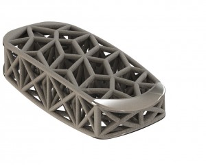 spine truss