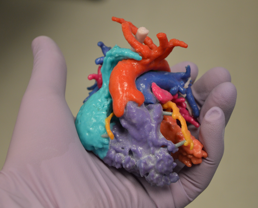A patient-specific pediatric heart model, 3D-printed in full color. (Image courtesy Phoenix Children's Hospital)