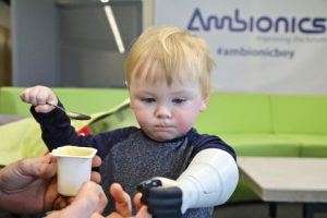 Sol Ryan, two years old, controls the thumb motion of his Stratasys 3D-printed training prosthetic. (Image courtesy Ambionics)