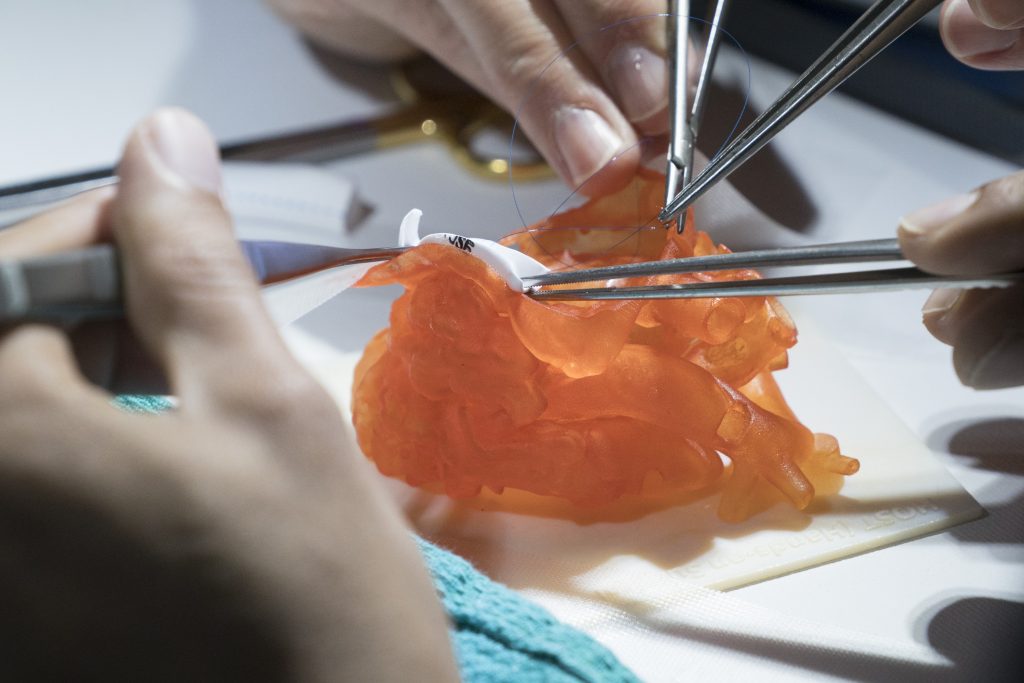 Heart model made of realistic 3D-printed material, used in surgical training at The Hospital for Sick Children, Toronto, Ontario. (Image courtesy Stratasys)