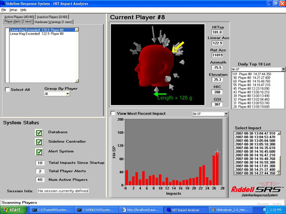 20101116fig3 This is an image of the Sideline Response System* from Riddell, which takes the HITS data from instrumented helmets and saves the data for later analysis