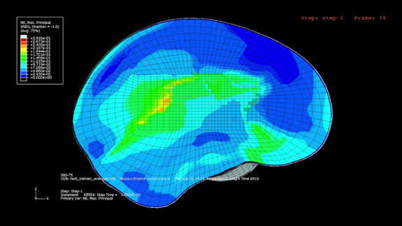 20101116fig4 This image shows a simulation of the stresses on the brain based on game data captured using Riddell’s HITS system of helmet sensors (image courtesy of Intel).