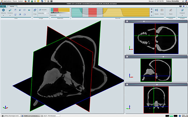 RETOMO can perform the segmentation process on all the slices in an image at once, as depicted here. Image courtesy of BETA CAE Systems.