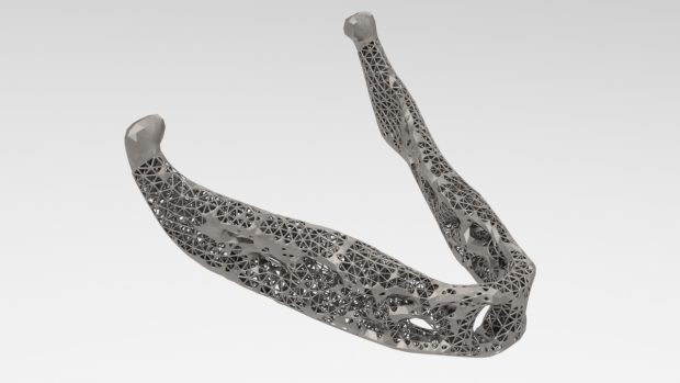 This image of a mixed solid and lattice optimization of a prosthetic human jaw was created with Inspire 2018. Image courtesy of Altair Engineering Inc.