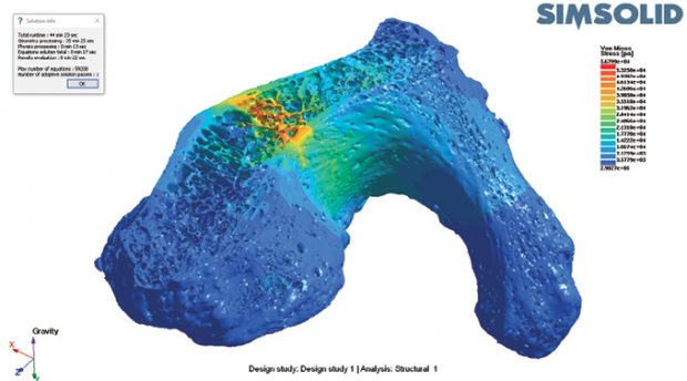 SIMSOLID, which champions meshless simulation, says its approach is well-suited for analyzing complex structures such as bones and lattice structures. Images courtesy of SIMSOLID.