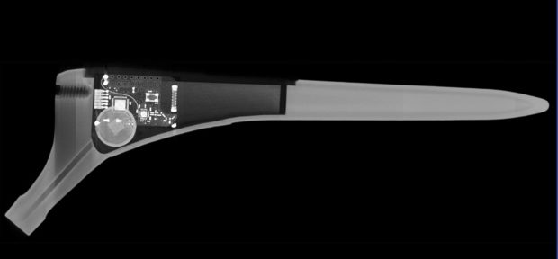 An X-ray image of a smart hip implant, showing the sensor. Image courtesy of Renishaw.