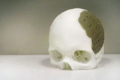 OsteoFab