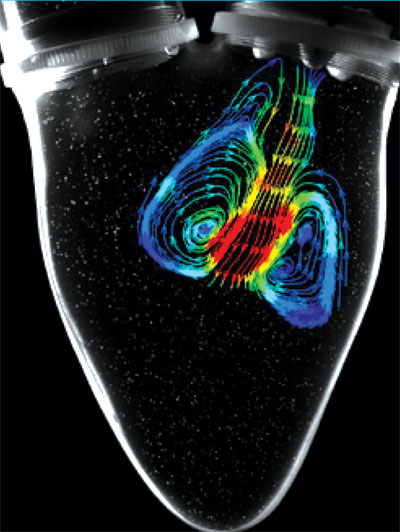 Heart Valve CFD