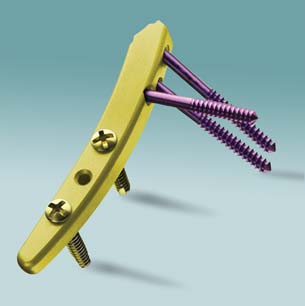 Siemens Teamcenter Drives Competitive Advantage Through PLM