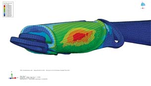 Visualizing Eye Surgery 