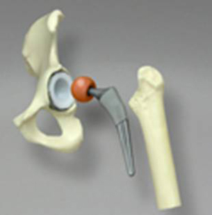 Galloway Plastics Offers Direct Metal Laser Sintering System from EOS&nbsp;