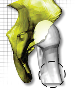 Using Patient-Specific Data as a Basis for Design