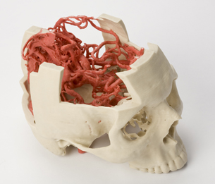 Z Corp&rsquo;s 3D Printed Models Aid Surgical Procedures