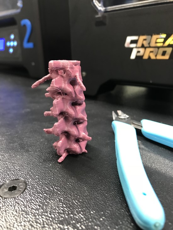 Sample vertebrae section (from converted CT scan data) printed with supports (removed) on a Flashforge Creator Pro, using Party Pink recycled HIPS filament from Closed Loop Plastics. Image courtesy Pamela Waterman    