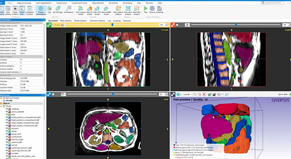 What's New in Simpleware Software W-2024.12