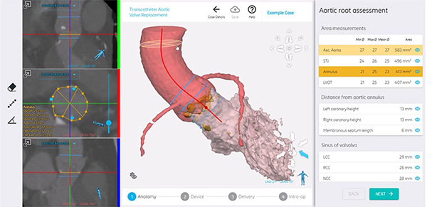 Materialise Buys FEops