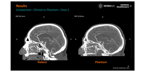 Stratasys and Siemens Healthineers Co-Develop Custom 3D-Printed Phantoms