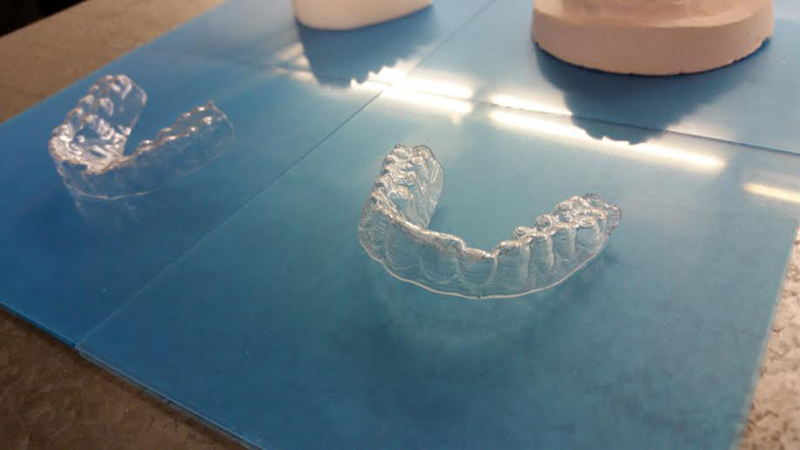 College Student 3D Prints Own Orthodontic Aligners