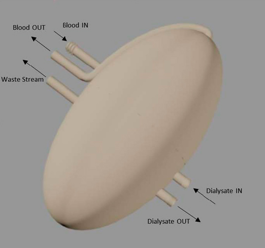 UConn Students Build 3D Printed Artificial Kidney