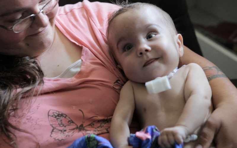 3D Printed Tracheal Splint Saves Baby’s Life