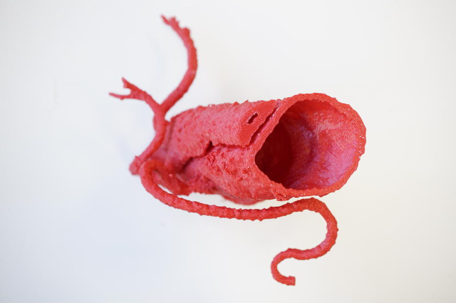 5 Ways 3D Printing Will Change Healthcare