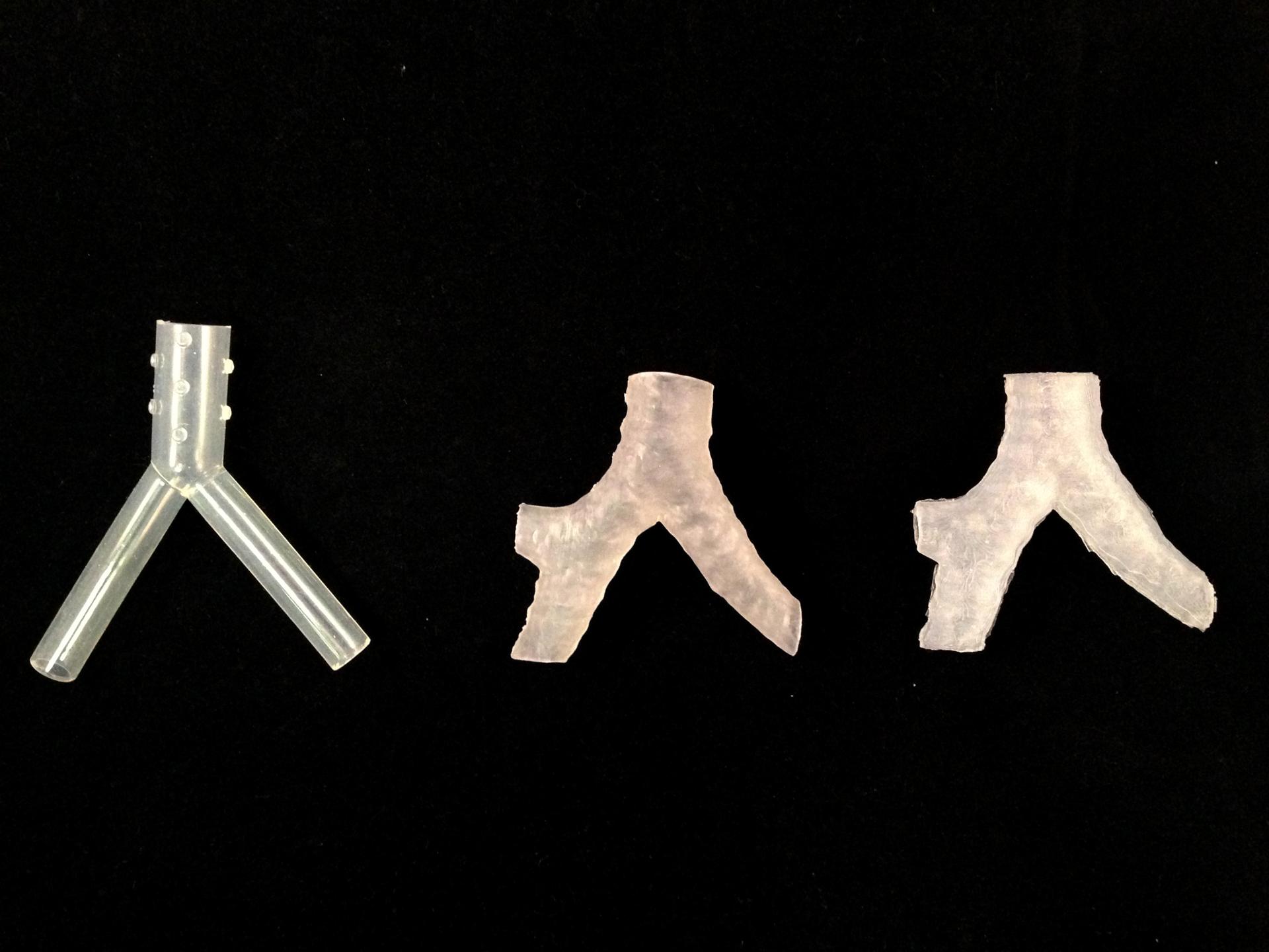 Hospitals Develop Custom Medical Implants with 3D Printing