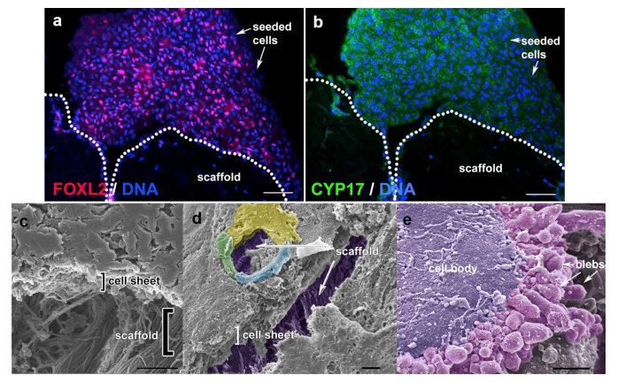 Printed Ovary Could Restore Fertility