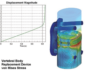 Saba Metallurgical and Plant Engineering Services used ALGOR MES to study this vertebral body replacement device. 